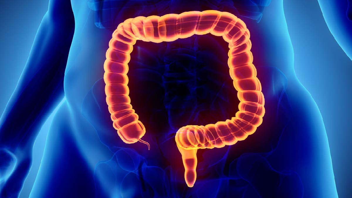 Colon illustration Medical illustration of the colon