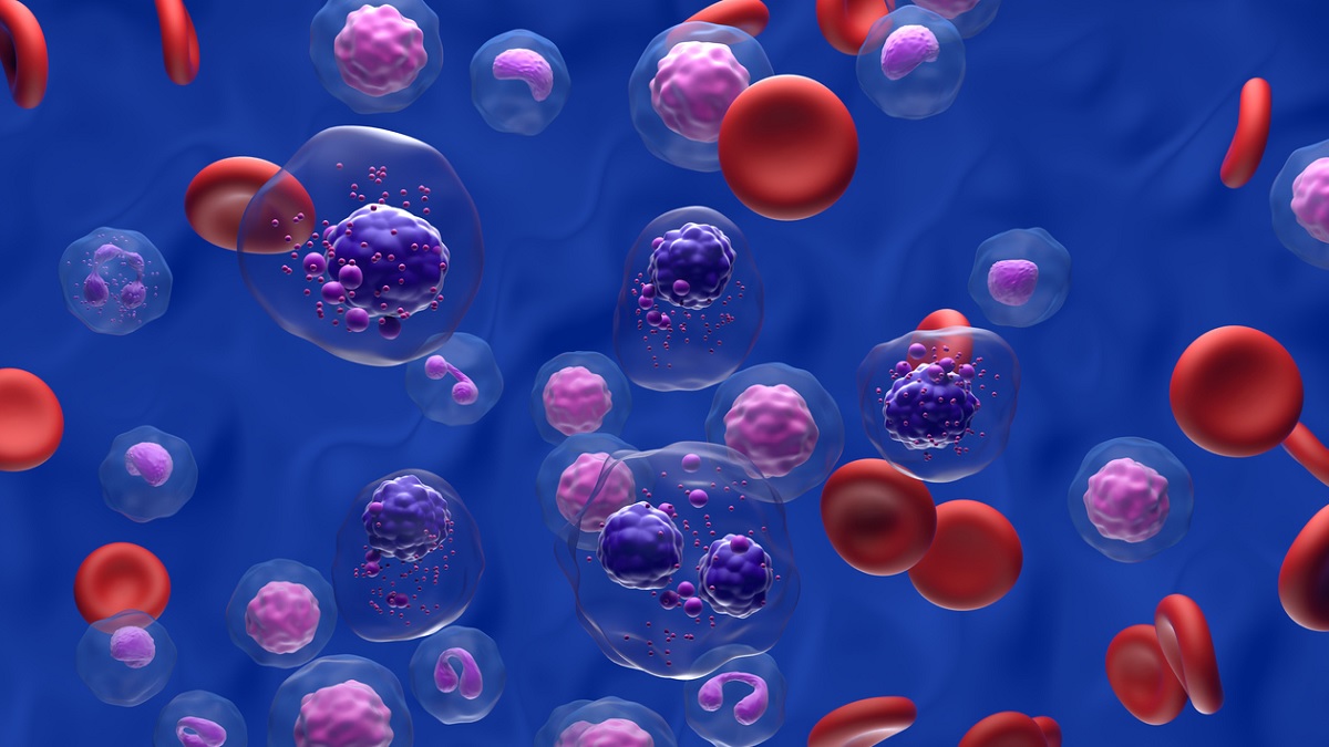 Myeloma illustration Illustration of myeloma cells in the blood