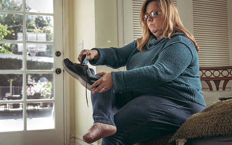Rebecca C., age 43, had all five toes on her right foot amputated because of Buerger&rsquo;s Disease